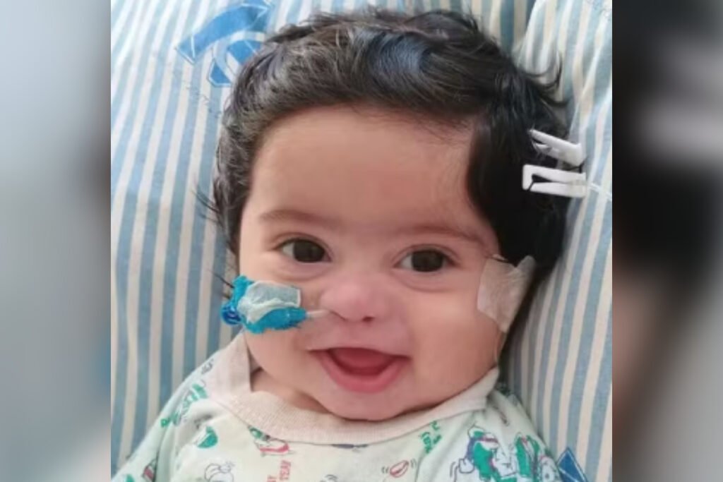 Bebê de 4 meses sorrindo em leito de hospital, com sonda no nariz